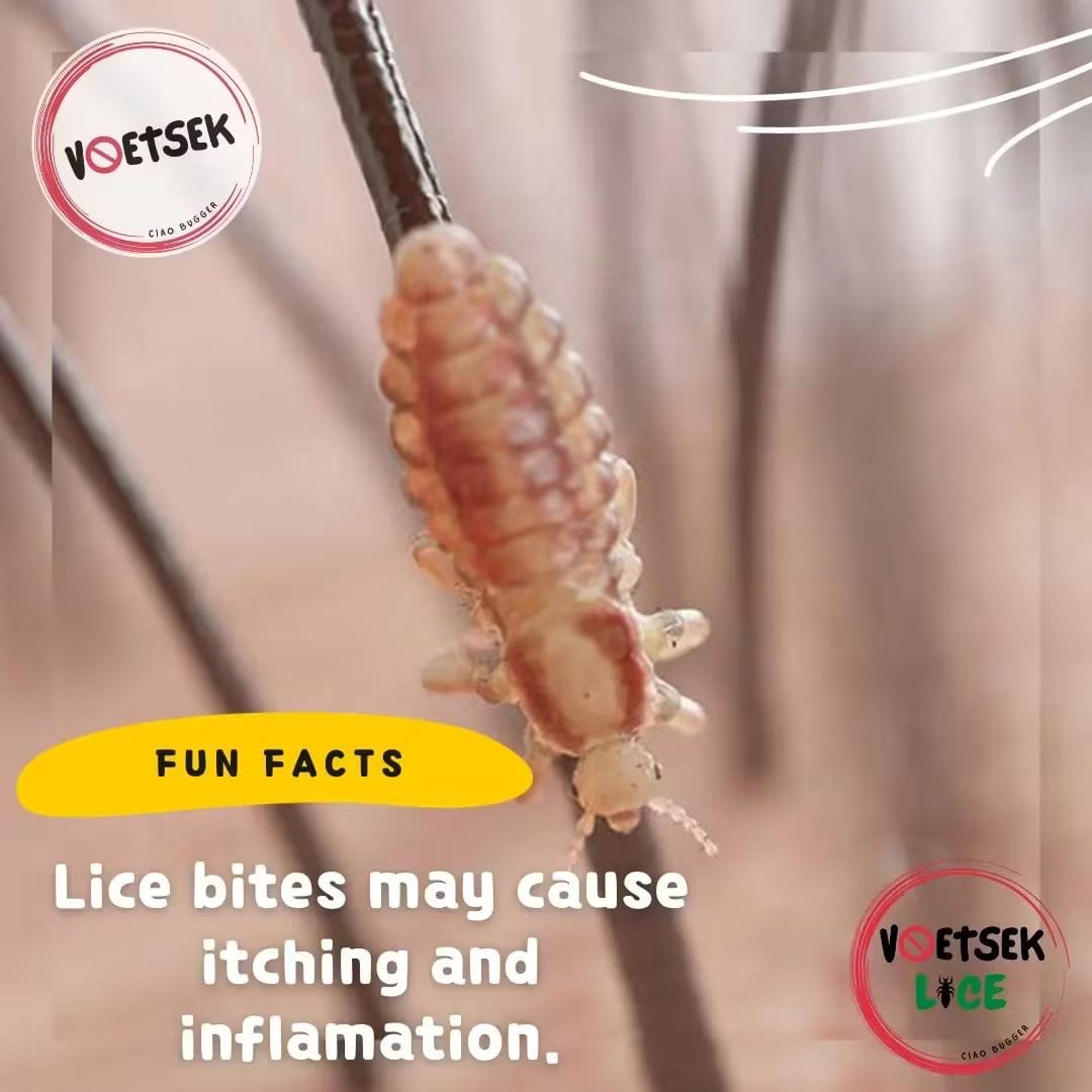 Magnified head louse clinging to a strand of hair; lice bites may cause itching and inflammation.